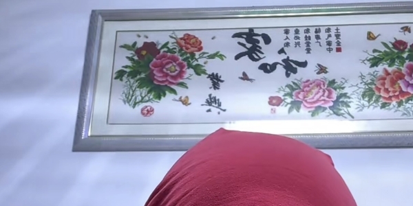 干细胞移植第184天